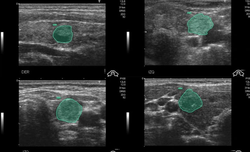 Solving cross-border talent gap for medical annotation across SEA