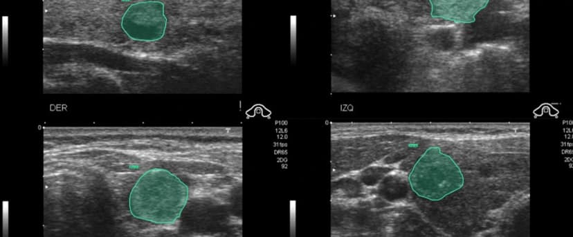 Solving cross-border talent gap for medical annotation across SEA